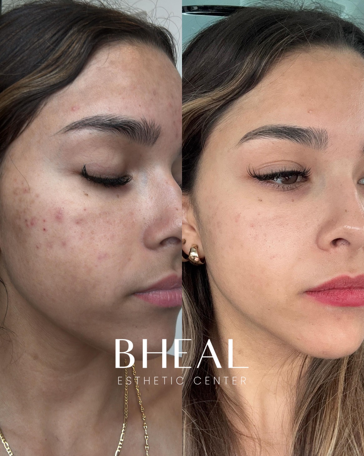 pigmentation